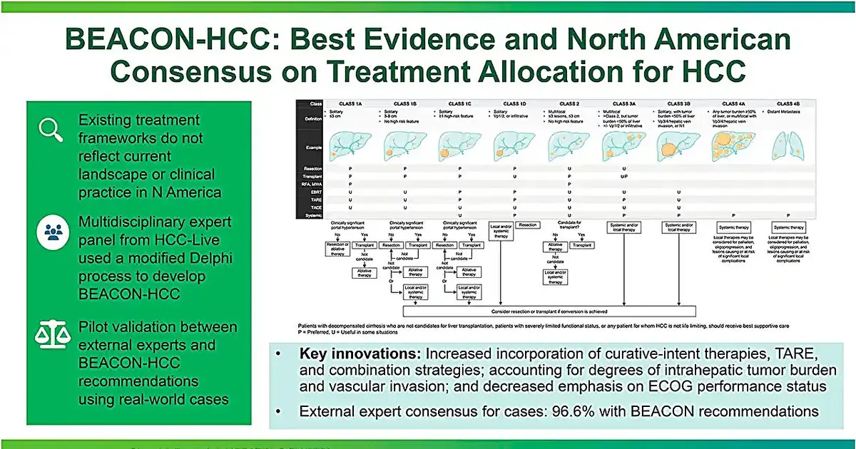 Liver cancer experts co-author new treatment framework for hepatocellular carcinoma
