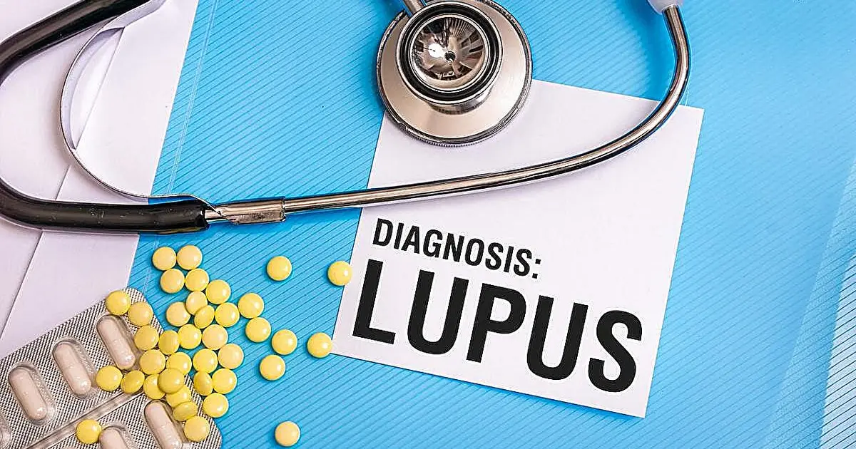 Lupus patients can lower their heart disease risk by sticking to one common treatment, study says