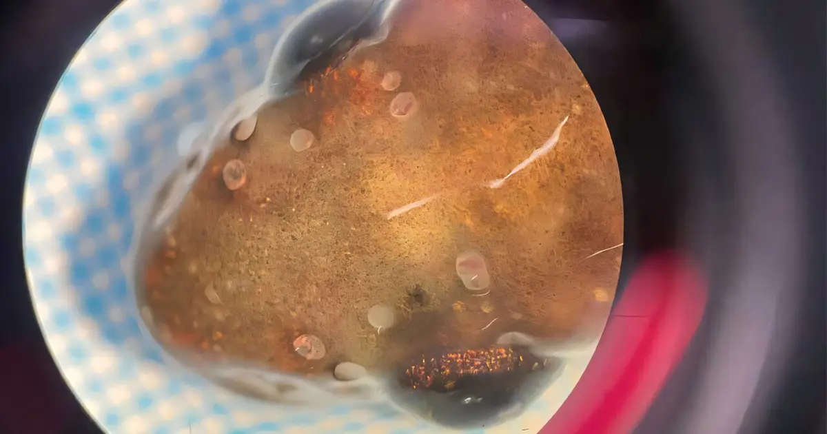 Marmite lures discovery from lake depths