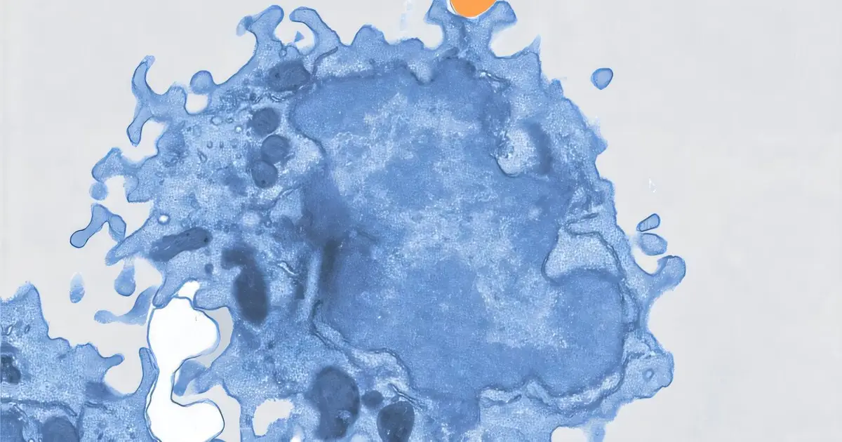 Microplastics clog liver immune cells, driving fat buildup in mice