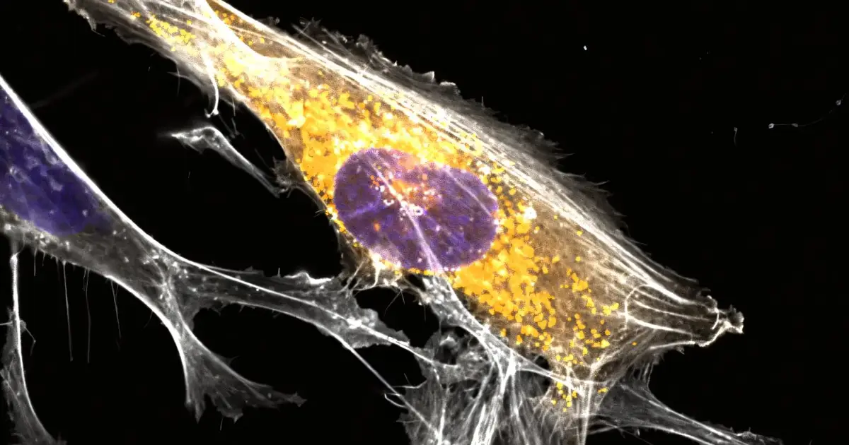 Microproteins provide new playbook for Alzheimer's research