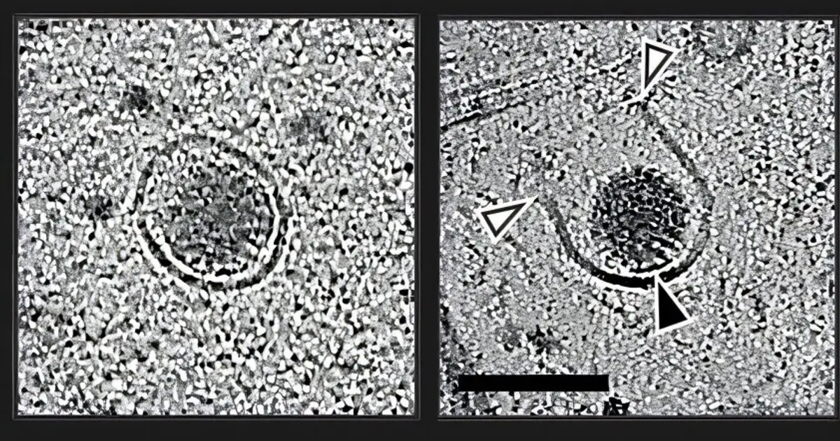 'Molecular movie' fills in blanks of how nonenveloped viruses infect cells