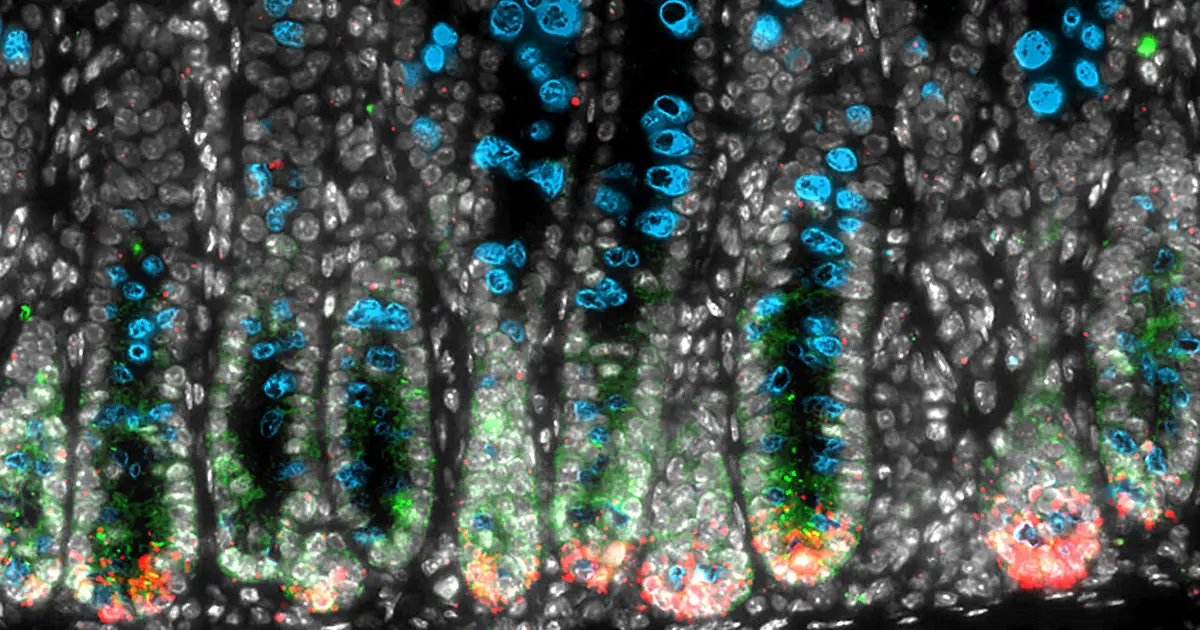 A 'molecular switch' that heals the gut—and that colorectal cancer hijacks to spread