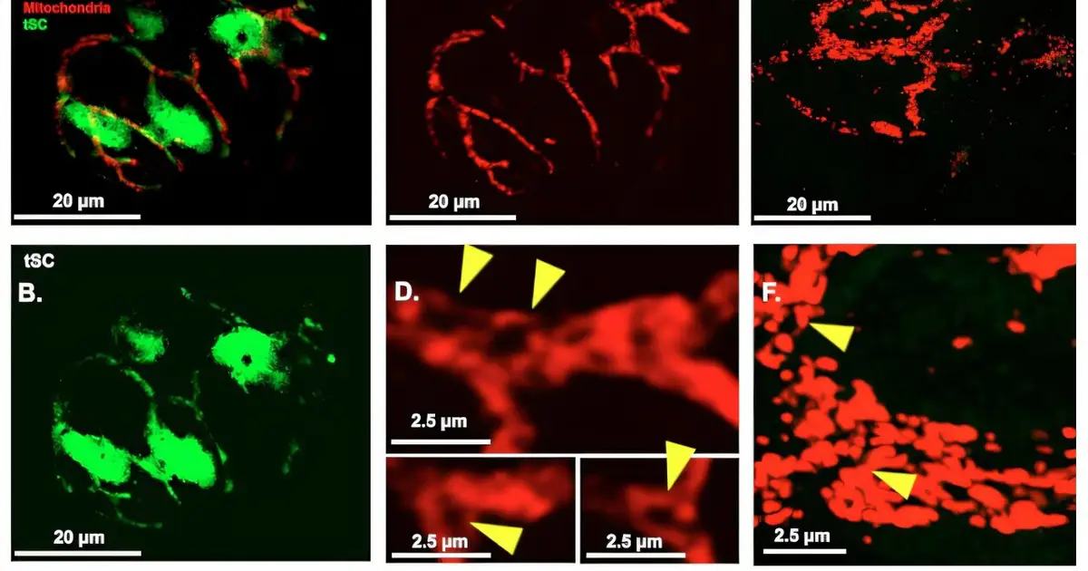 A closer look at hard-to-see cells could answer new questions about nerve damage and recovery