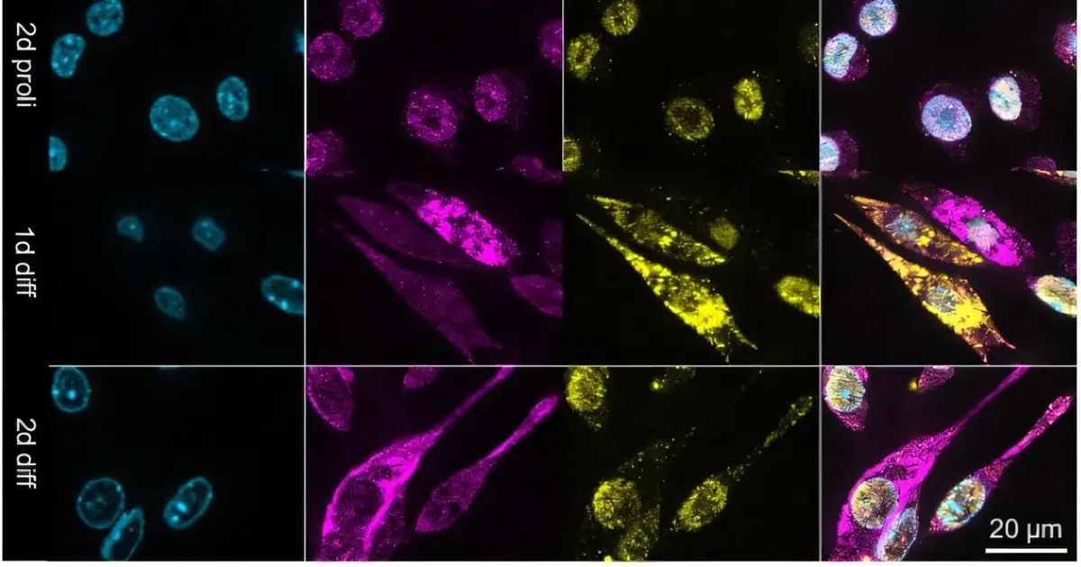 Protein LMOD1 offers new clues to muscle regeneration