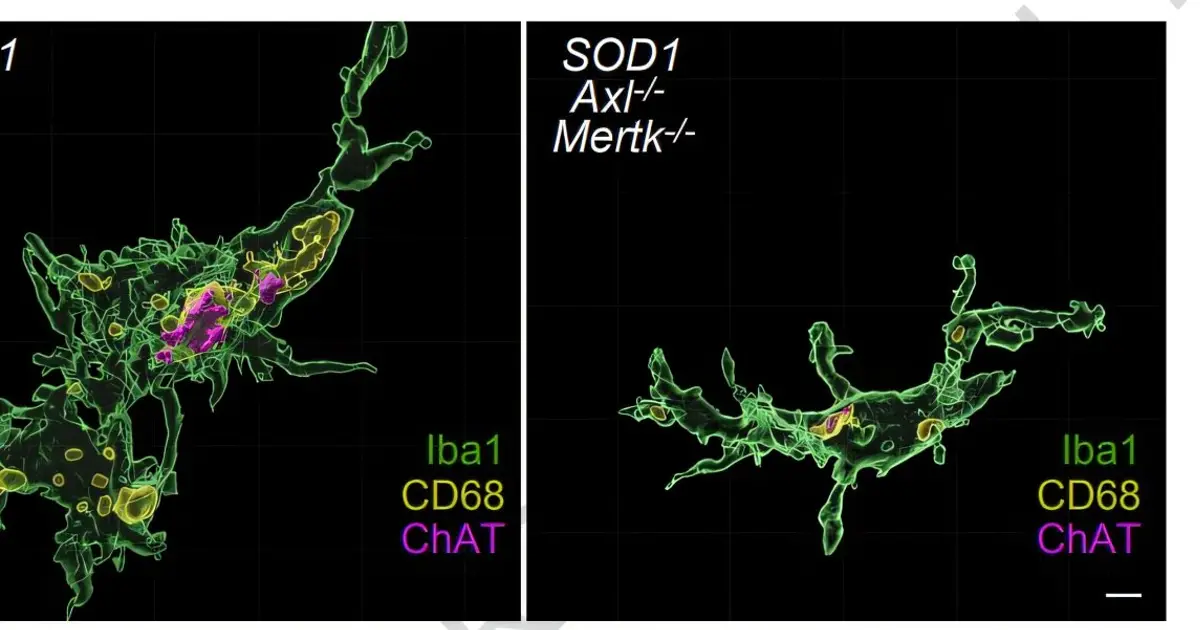 Microglia caught eating living motor neurons in ALS mice via unexpected immune pathway