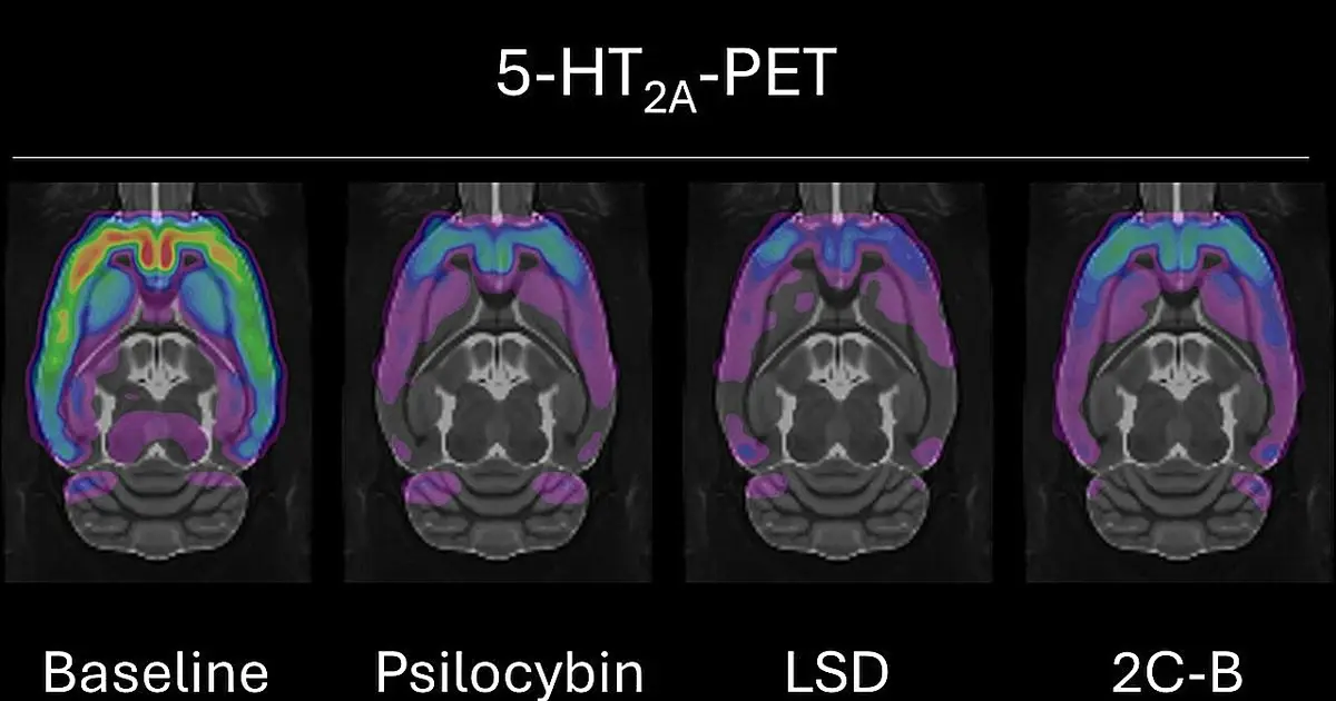 Three psychedelic drugs affect the brain differently, brain scans in rats suggest