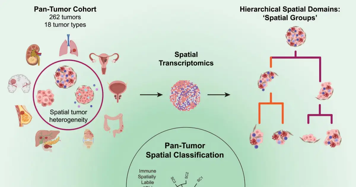 Tumor 'floor plans' may predict immunotherapy response better than current biomarkers