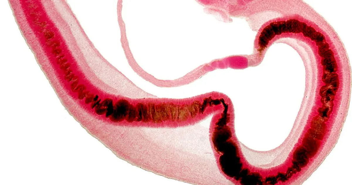 Not all eggs are the same—uncovering a tropical parasite's secret weapons
