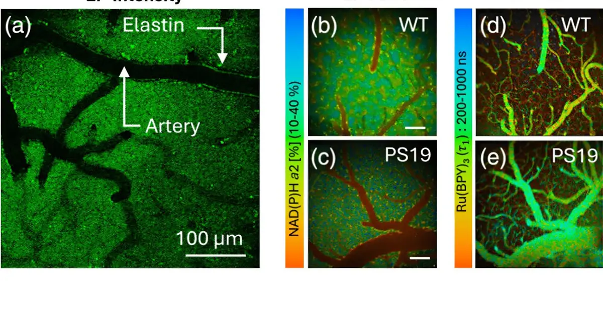 Optical imaging links altered metabolism and oxygen use in Alzheimer's disease