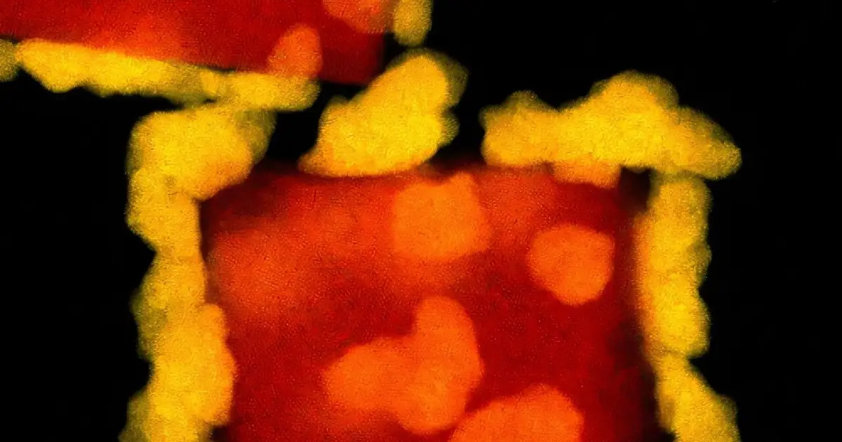 Electron and photon beams drive same gold-forming reaction toward different nanoscale structures