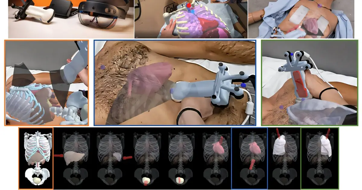 Predictive anatomical guidance system helps novice users acquire trauma ultrasound images