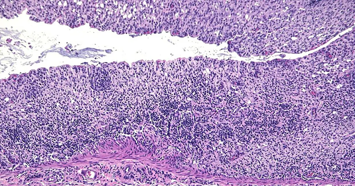 Protein reins in intestinal inflammation by curbing an overactive immune signal