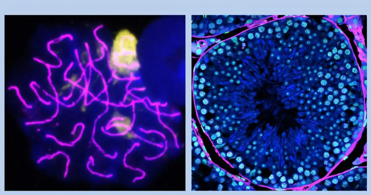 An overlooked protein may decide how fast male fertility starts to unravel with age