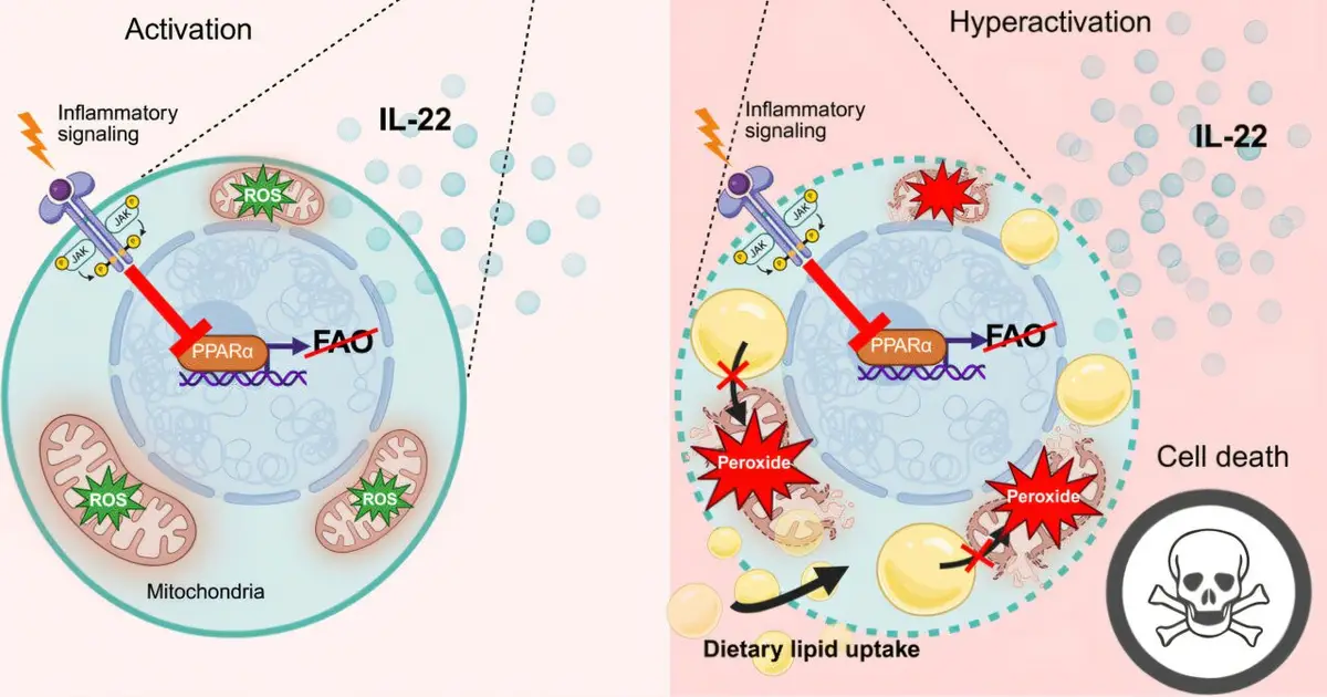 High‑fat diets linked to rapid decline in protective gut immune cells