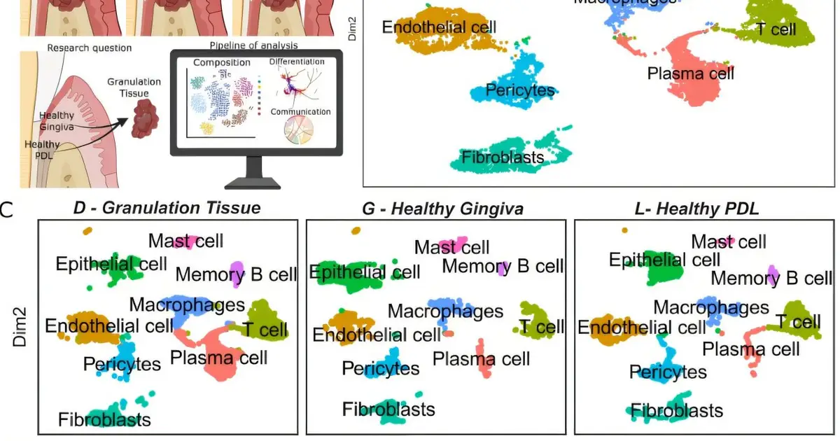Research uses cutting - edge technology to map how gums become diseased