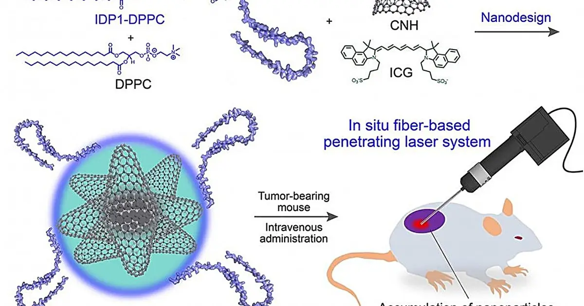 Combined nanoparticle and internal laser method could make cancer therapy less invasive