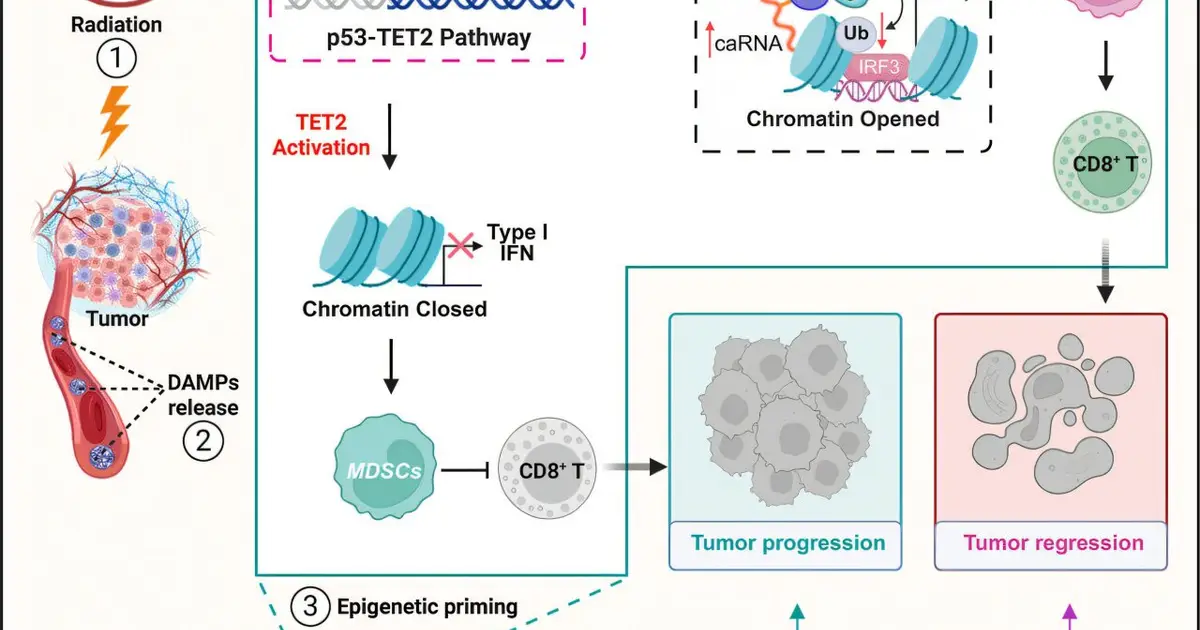 Reversing radiation-activated immune suppression in cancer