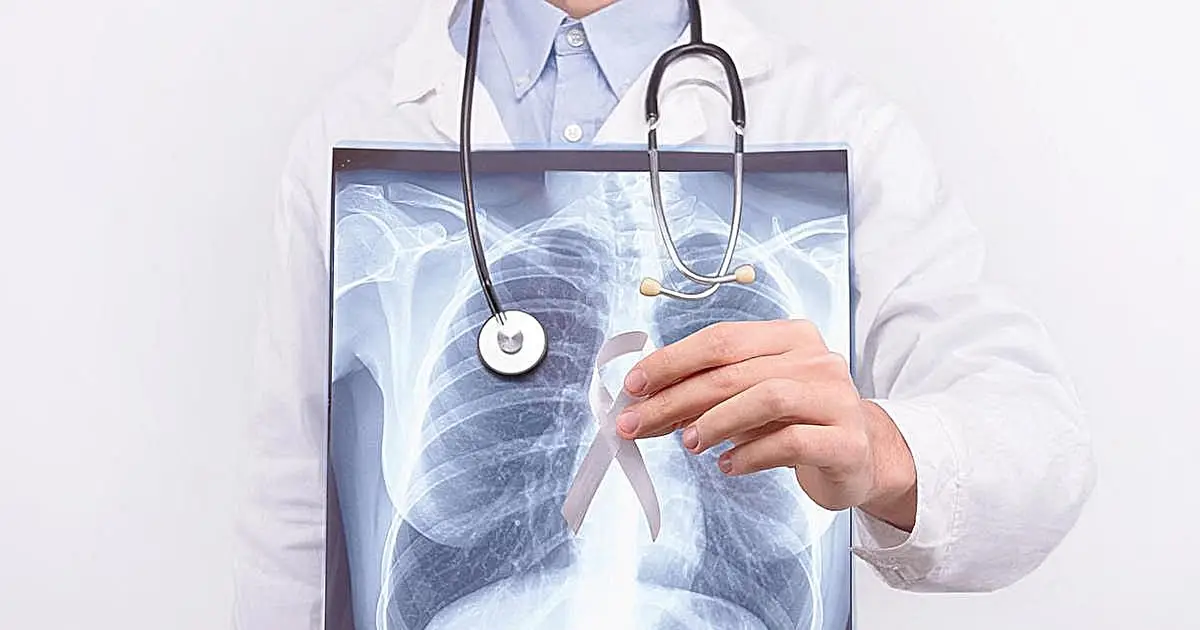 Risk-based strategies superior to US Preventive Services Task Force criteria for lung cancer screening