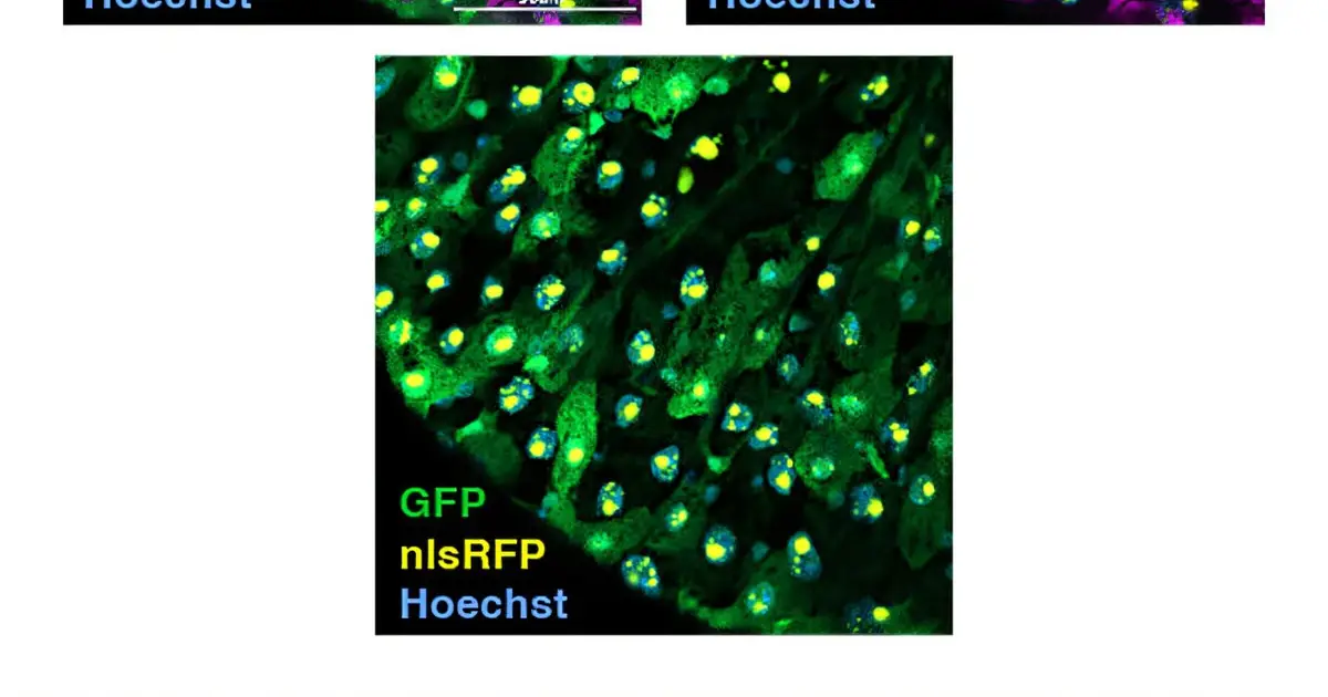 Gut cells may measure hunger by how watery their insides become