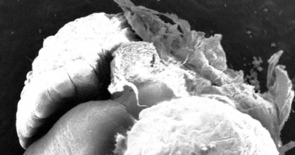 Lymphatic vessels use Reelin protein to help regulate embryonic heart growth