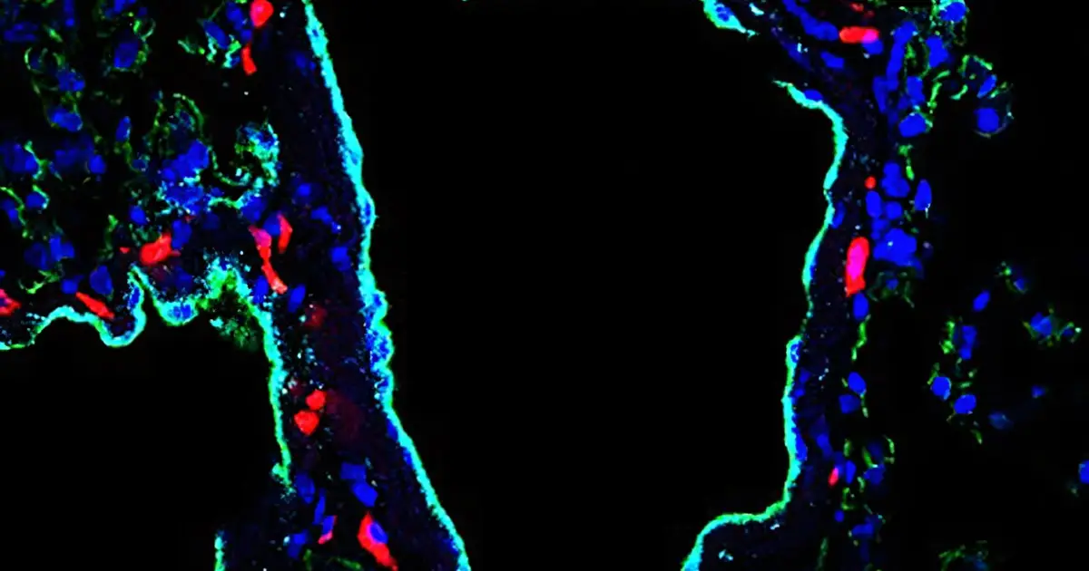 Tumor-secreted protein makes lung vessels leakier, promoting metastasis