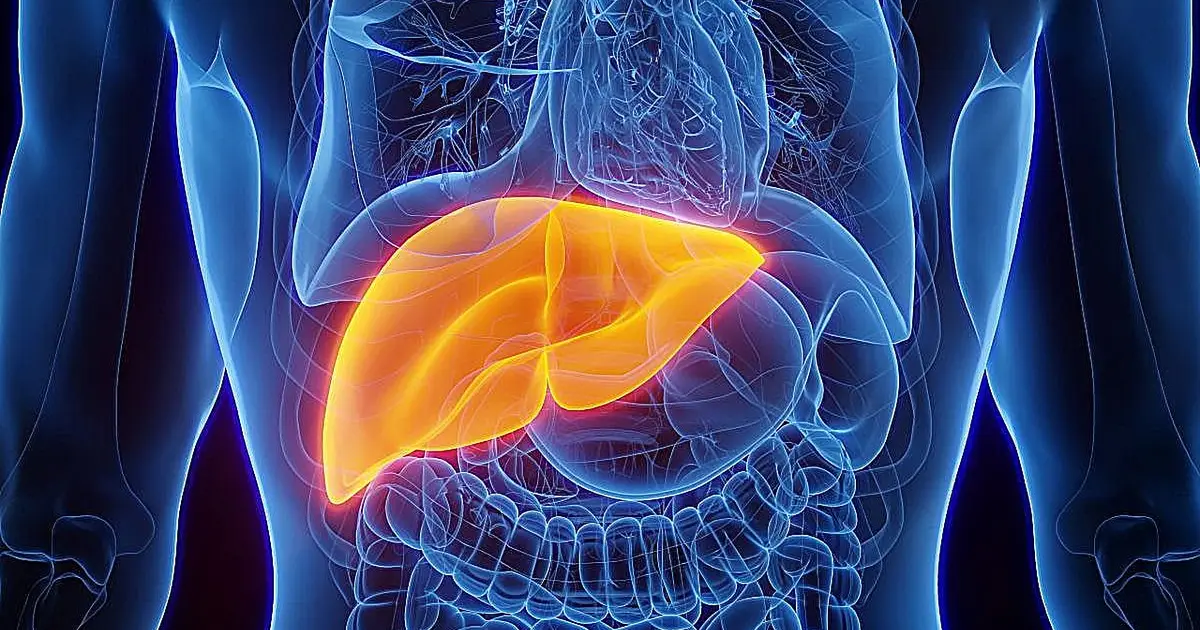 Steatotic liver disease risk scores compared for predicting cirrhosis