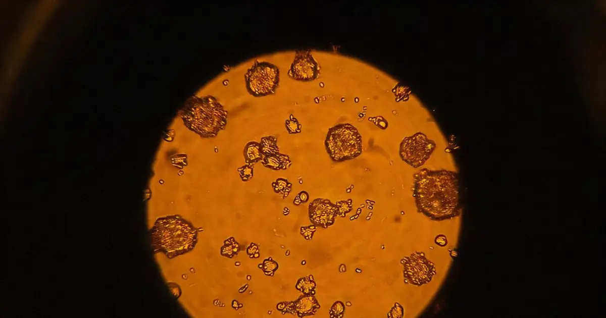 Stem cells survive unexpectedly rough space travel