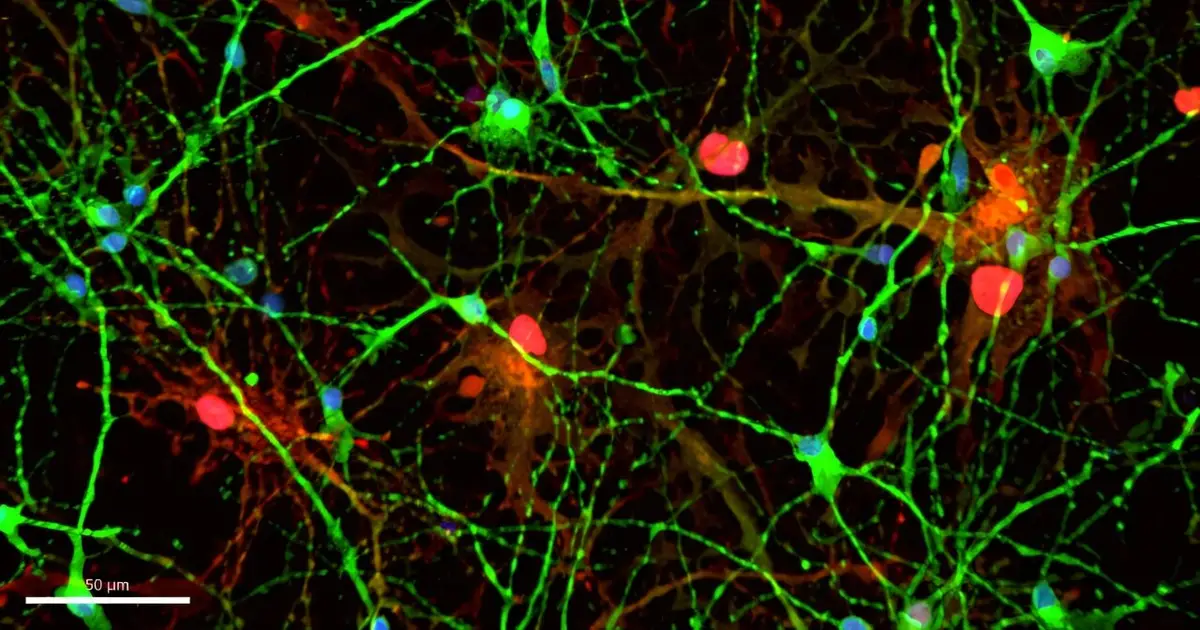 Alzheimer's patients show elevated active meprin-β in brain and cerebrospinal fluid