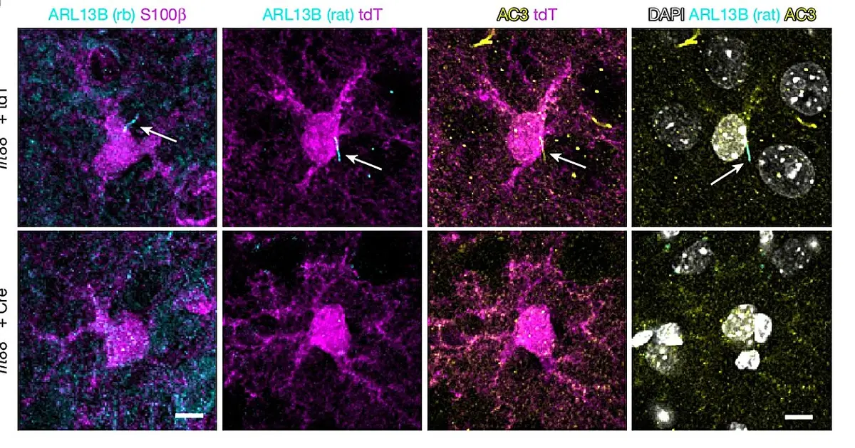 Tiny astrocyte sensors in the brain's fear center point to a potential target for anxiety and depression