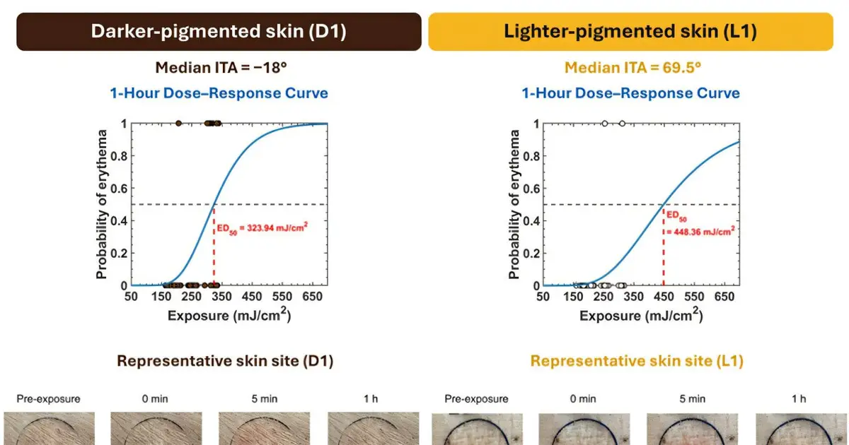 Pigmentation measurement could improve laser safety standards across skin tones