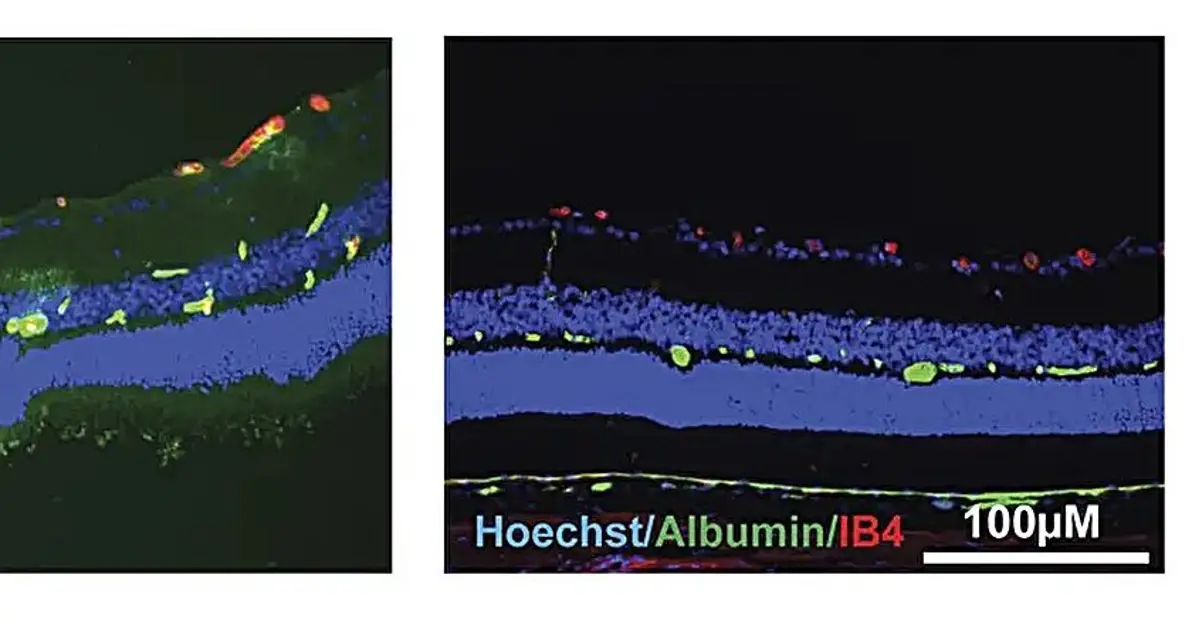 Treatment with norrin helps maintain healthy blood vessels and preserve vision in diabetic rats