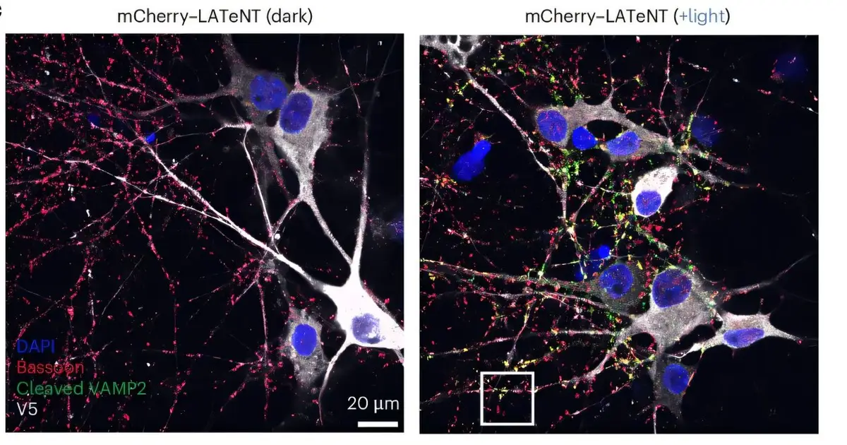 Turning brain neurons on and off with light: A reversible synaptic switch