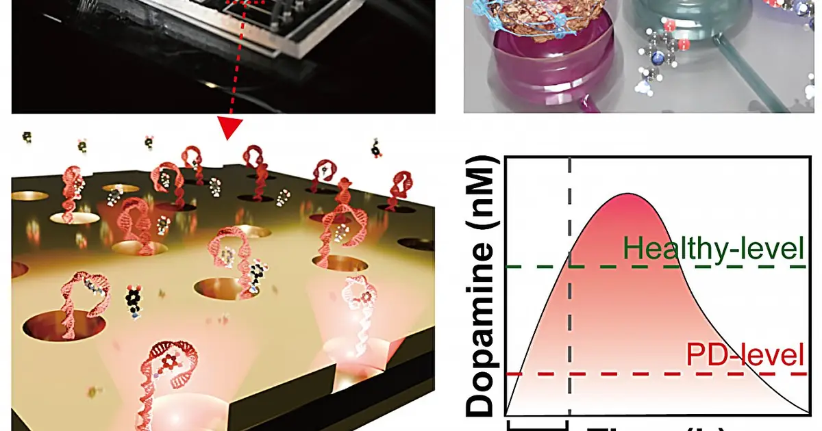 Gold nanoplasmonic chip tracks L-DOPA response in Parkinson's 'mini-brains'