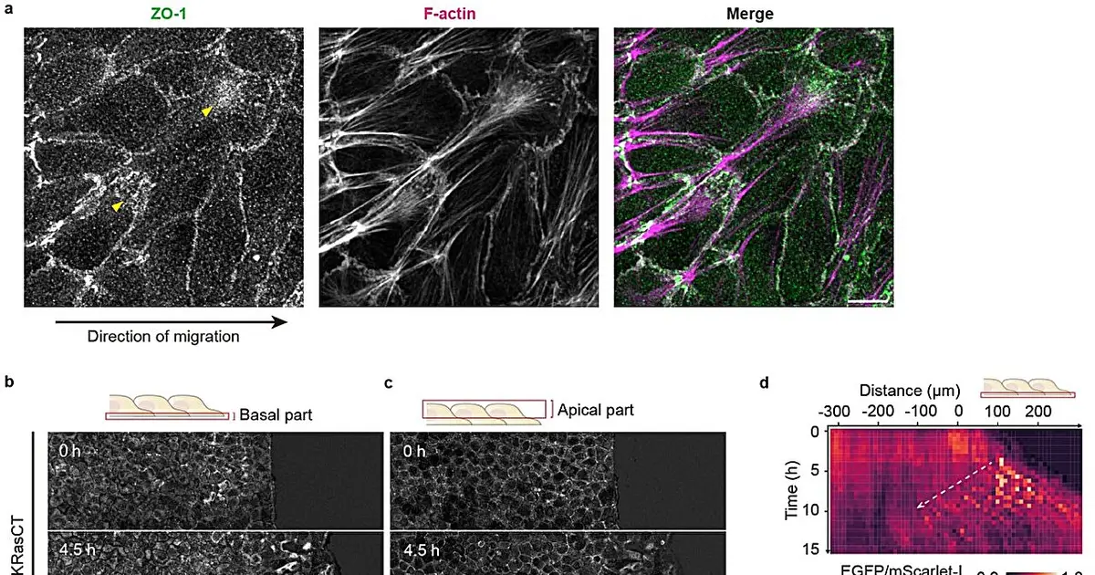 Understanding the mechanisms of collective cell movement