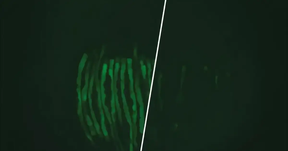 Vitamin B12 corrects developmental defects in Verheij syndrome worm model