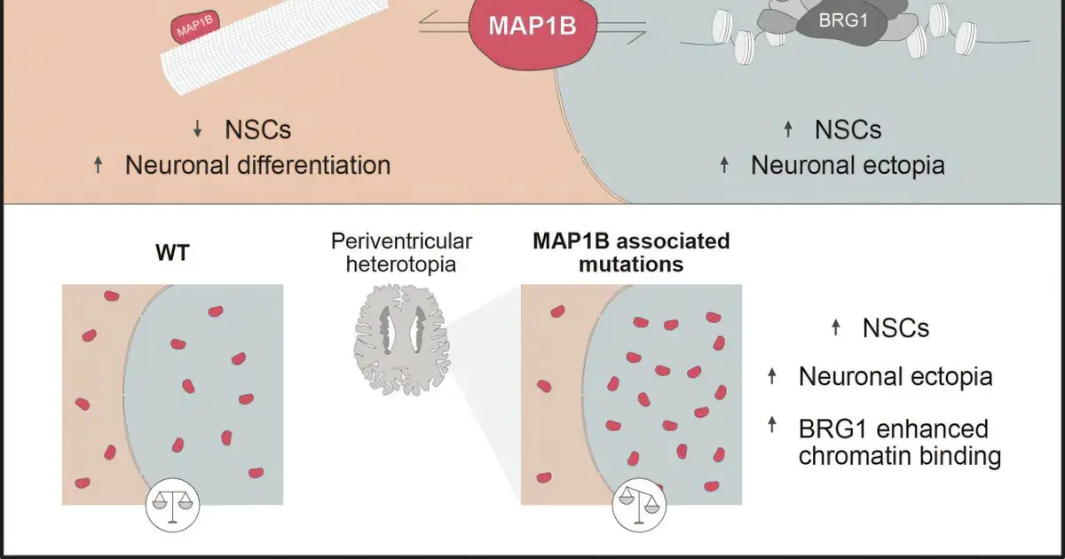 MAP1B reveals unexpected role for cytoskeletal proteins in brain development