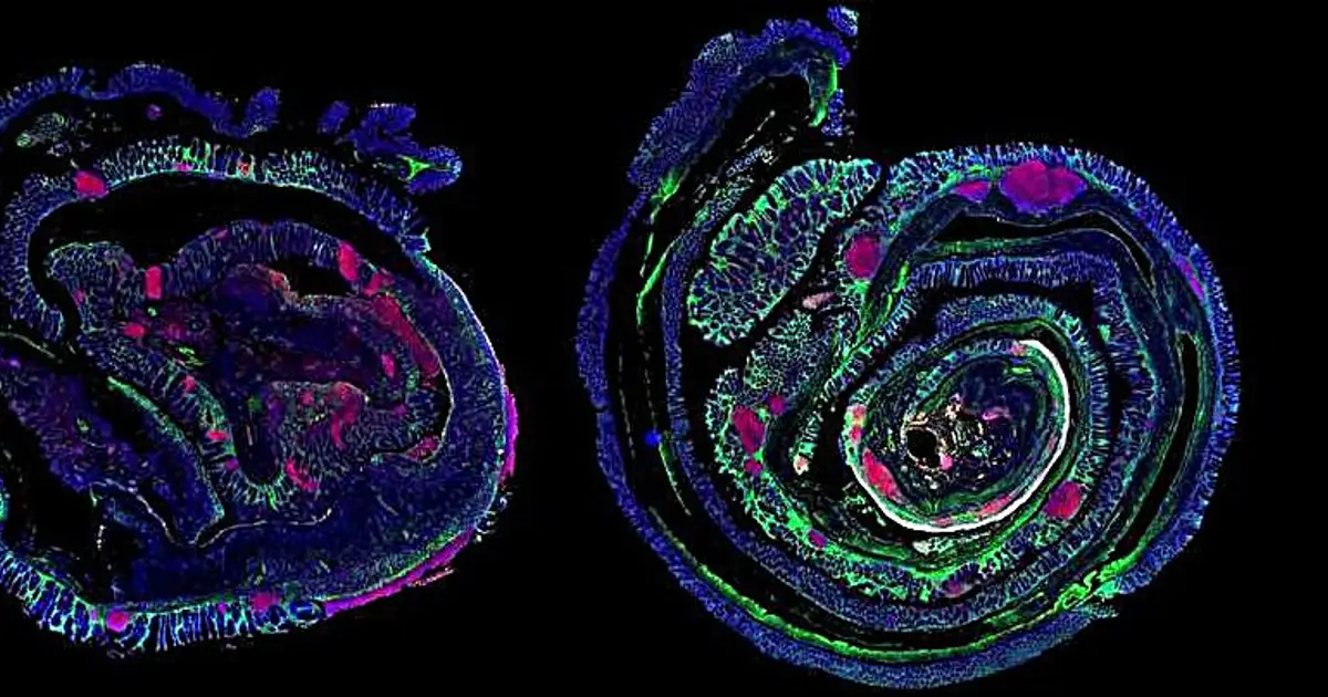 Gut tissue may retain inflammatory 'memory' for more than a year
