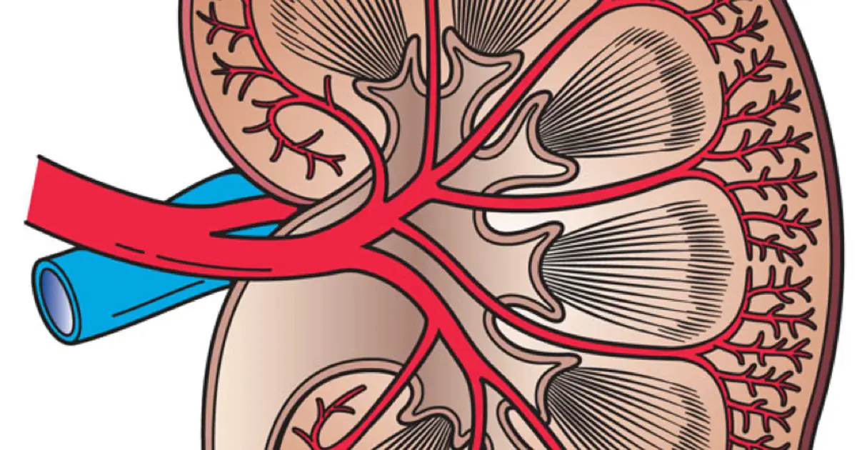 Multicenter study suggests early rasburicase prevents kidney failure and death in tumor lysis syndrome