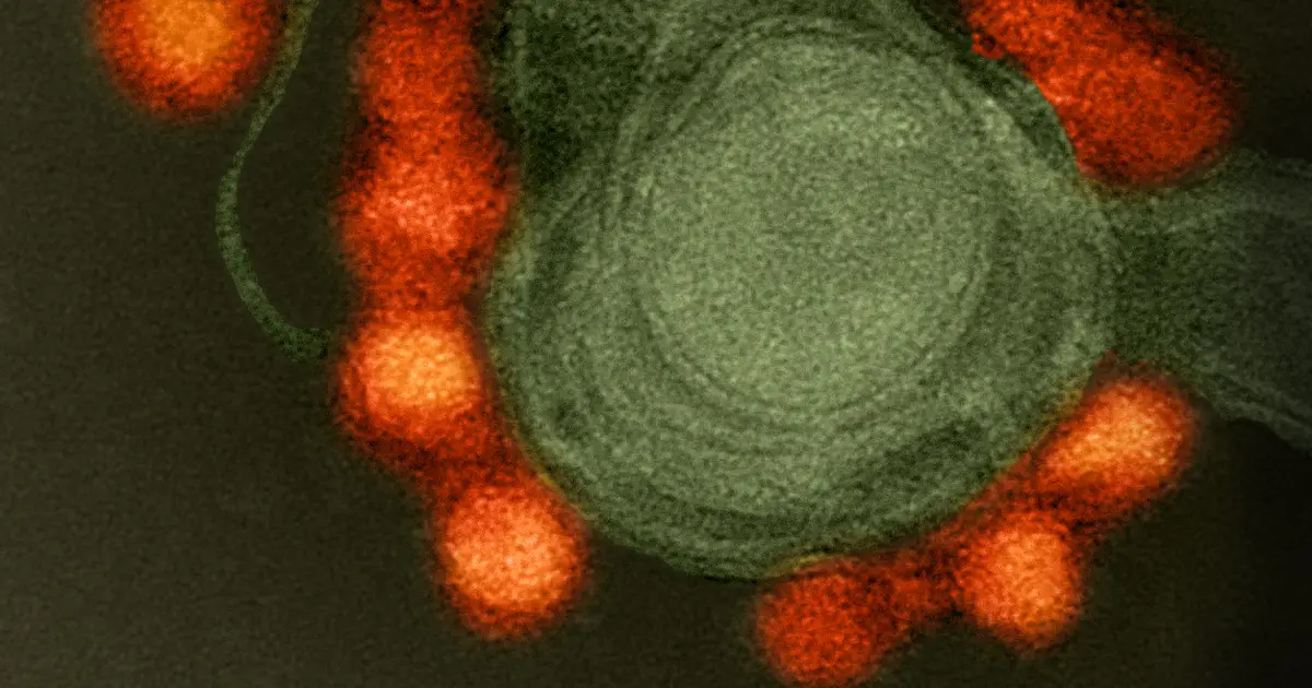 AI‑designed viruses are a test of whether biosecurity can keep pace