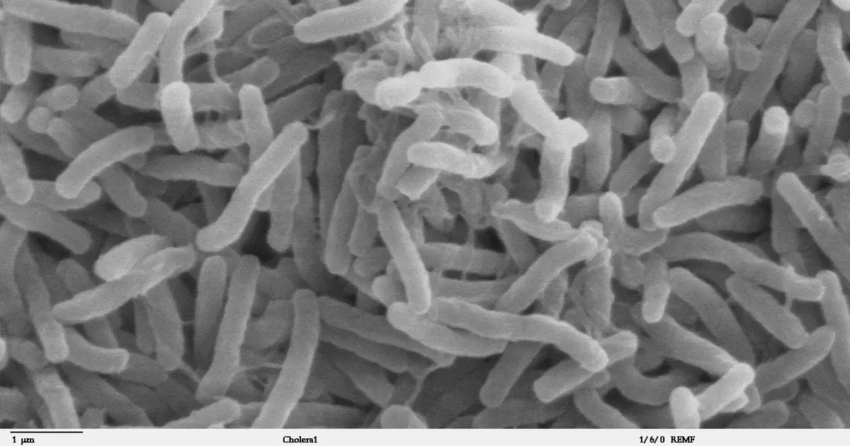 Cholera still kills thousands each year. In places without clean water, it's far from history