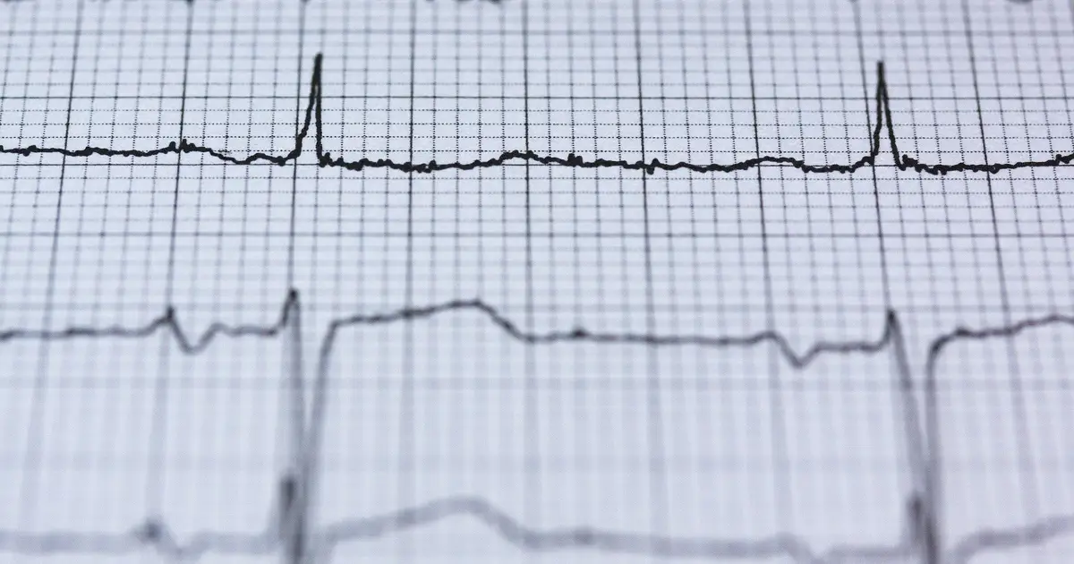 Closing the gap between suspecting a heart attack and confirming it