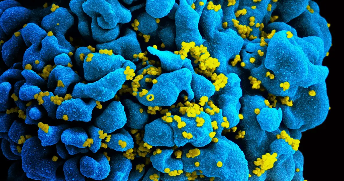 Why women with HIV are still dying early, even when virus is not main cause