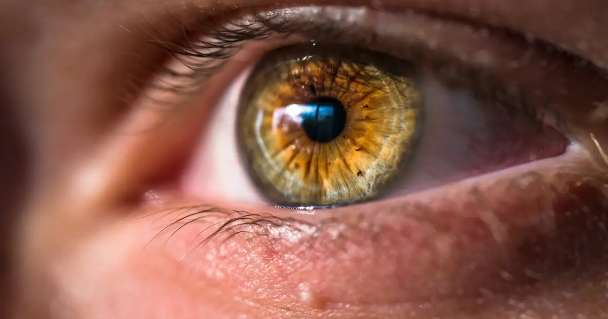The fake disease that fooled the internet, and what it says about all of us
