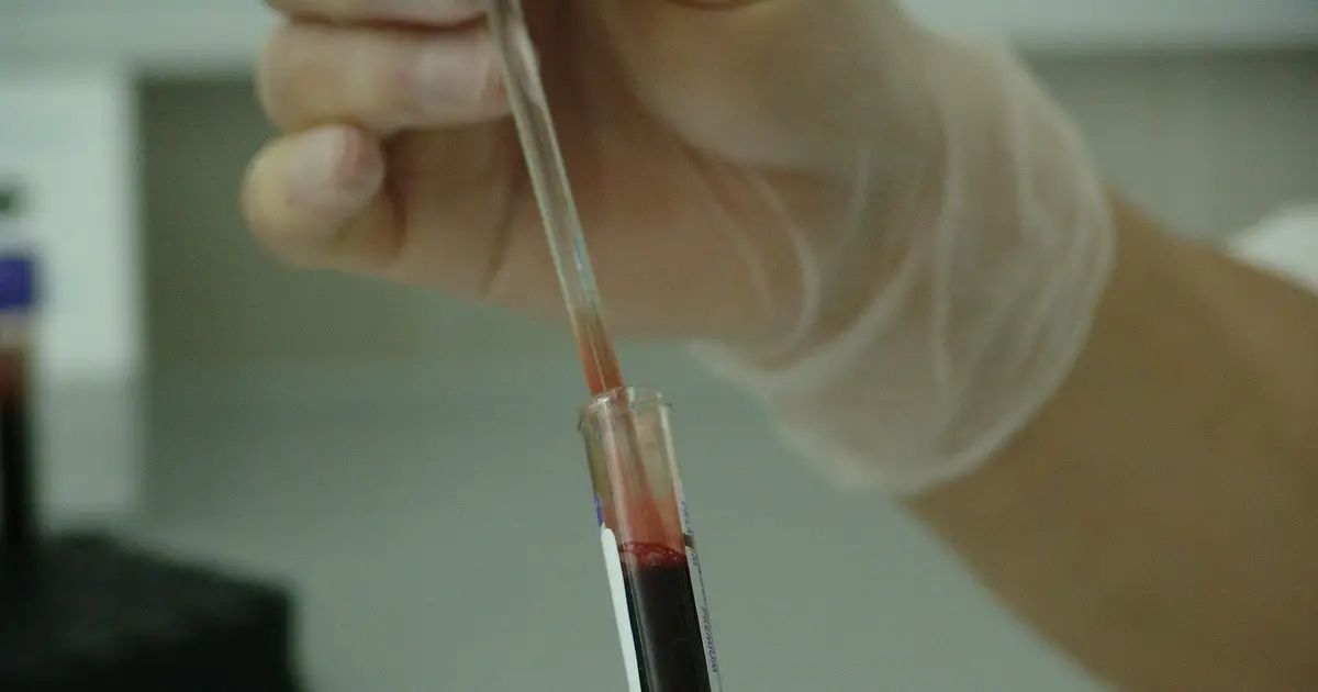 Genetic testing may help identify inherited blood disorder carrier status earlier