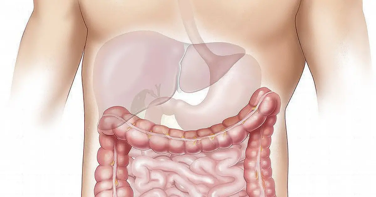Improve IBD bowel checks for early cancer detection