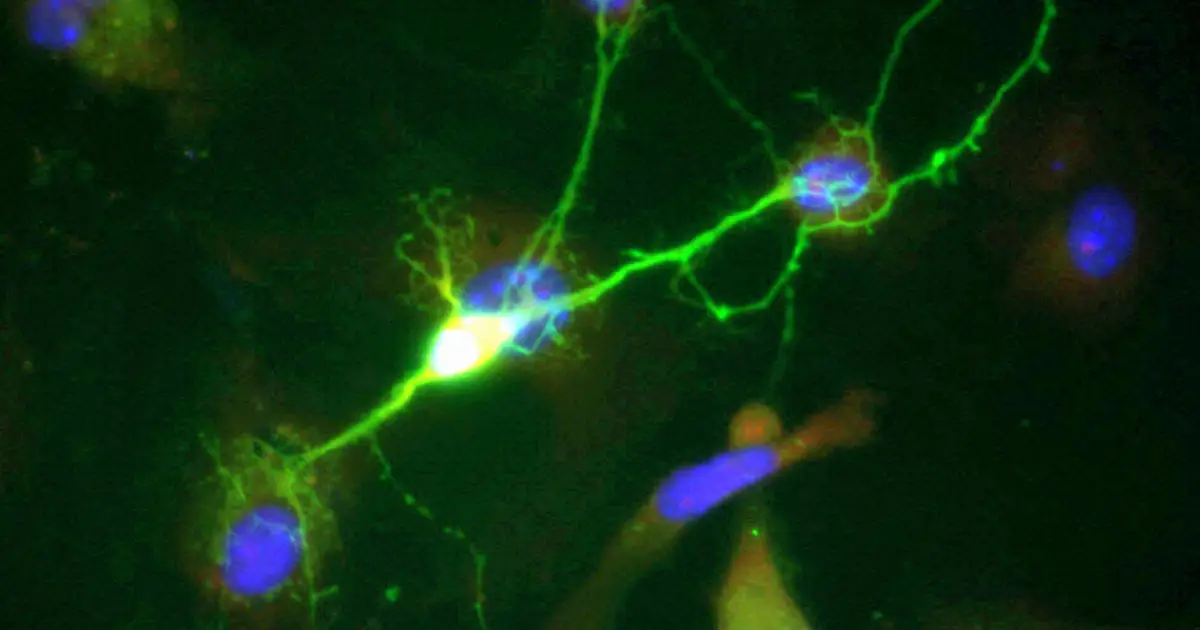 High-speed microscopy reveals electrical activity across the brain