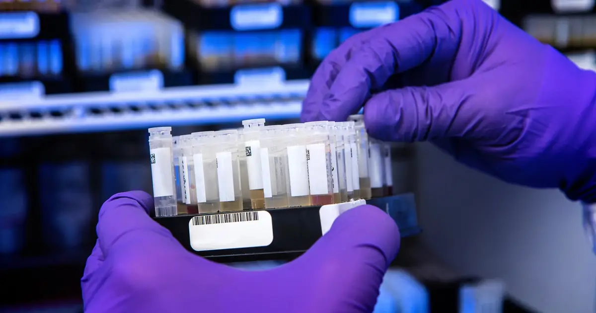 Masked antibodies may open intracellular treatment route for Parkinson's disease