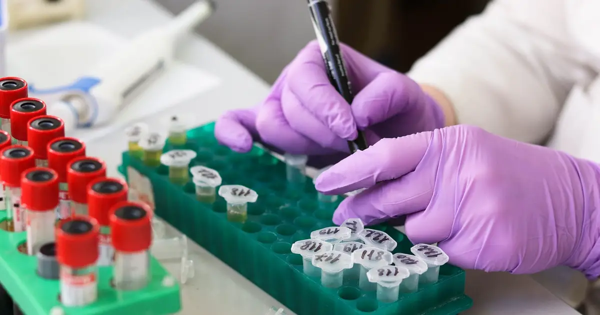 Blood-based test can predict risk of developing symptoms of Alzheimer's up to a decade early