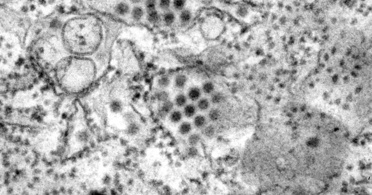 India approves first dengue vaccine